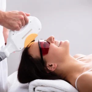 Depilación láser facial completa