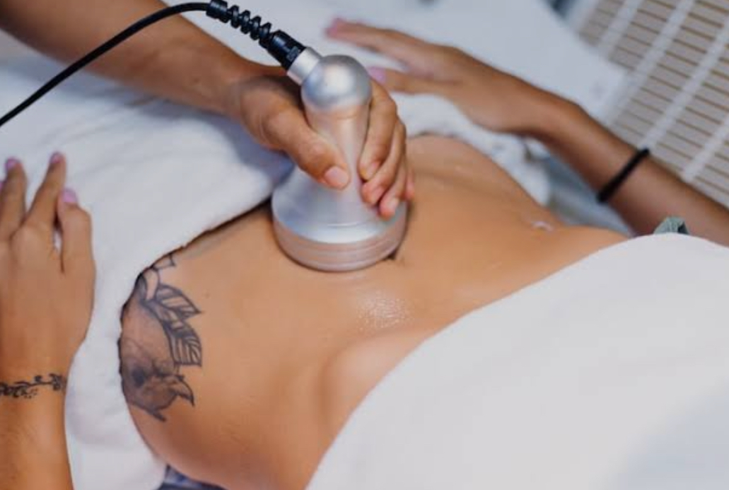 BONO PLAN REDUCTOR Y REAFIRMANTE